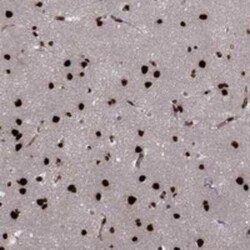 USP54 Rabbit anti-Human, Polyclonal, Novus Biologicals 100 &mu;g; Unconjugated:Antibodies,