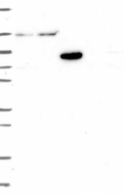 USP54 Rabbit anti-Human, Polyclonal, Novus Biologicals 100 &mu;g; Unconjugated:Antibodies,