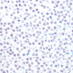 USP7 Rabbit anti-Human, Mouse, Rat, Clone: 3J7G1, Novus Biologicals:Antibodies:Primary