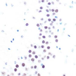 USP7 Rabbit anti-Human, Mouse, Rat, Clone: 3J7G1, Novus Biologicals:Antibodies:Primary