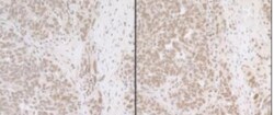 USP7 Antibody, Novus Biologicals 100 &mu;L | Buy Online | Novus Biologicals | Fisher Scientific