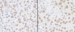 USP7 Antibody, Novus Biologicals 100 &mu;L | Buy Online | Novus Biologicals | Fisher Scientific