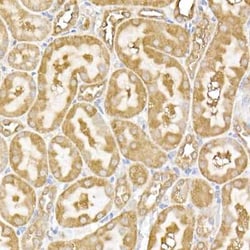 USP9Y Rabbit anti-Human, Mouse, Rat, Polyclonal, Novus Biologicals:Antibodies:Primary