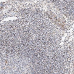 UST Antibody, Novus Biologicals 25 &mu;L; Unlabeled:Antibodies, Polyclonal