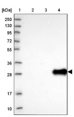 UTP11L Antibody, Novus Biologicals 0.1mL; Unlabeled:Antibodies, Polyclonal