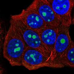 UTP14C Antibody, Novus Biologicals 0.1mL; Unlabeled:Antibodies, Polyclonal
