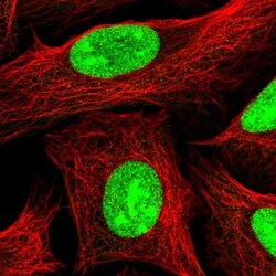 UTP18 Antibody, Novus Biologicals 0.1mL; Unlabeled:Antibodies, Polyclonal