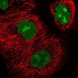 UTP18 Antibody, Novus Biologicals 0.1mL; Unlabeled:Antibodies, Polyclonal
