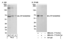 UTP18 Antibody, Novus Biologicals 0.1mL; Unlabeled:Antibodies, Polyclonal
