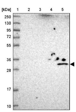 UTP23 Antibody, Novus Biologicals:Antibodies:Primary Antibodies