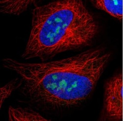UTP3 Antibody, Novus Biologicals 0.1mL; Unlabeled:Antibodies, Polyclonal
