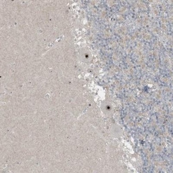 UTP3 Antibody, Novus Biologicals 0.1mL; Unlabeled:Antibodies, Polyclonal
