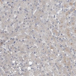 UTP6 Antibody, Novus Biologicals 25 &mu;L; Unlabeled:Antibodies, Polyclonal