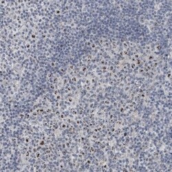 UTP6 Antibody, Novus Biologicals 25 &mu;L; Unlabeled:Antibodies, Polyclonal