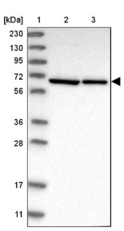 UTP6 Antibody, Novus Biologicals 25 &mu;L; Unlabeled:Antibodies, Polyclonal