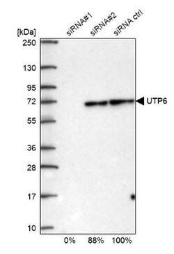 UTP6 Antibody, Novus Biologicals 25 &mu;L; Unlabeled:Antibodies, Polyclonal