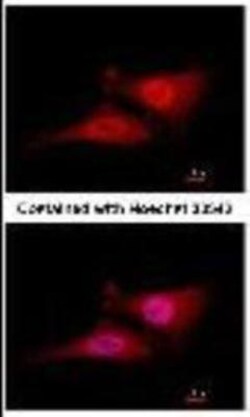 UBE2R1/CDC34 Antibody (14B5), Novus Biologicals 0.1mL; Unlabeled:Antibodies,