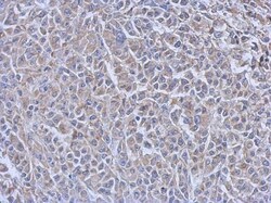 UBE2R1/CDC34 Antibody (14B5), Novus Biologicals 0.1mL; Unlabeled:Antibodies,