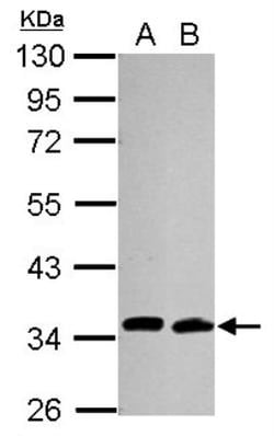 UBE2R1/CDC34 Antibody (14B5), Novus Biologicals 0.1mL; Unlabeled:Antibodies,