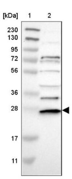 UBE2R1/CDC34 Antibody, Novus Biologicals 0.1mL; Unlabeled:Antibodies, Polyclonal