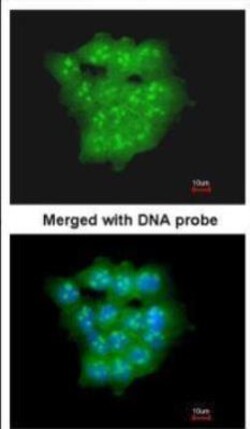 UbcH5a/UBE2D1 Antibody, Novus Biologicals 0.1mg; Unlabeled:Antibodies,