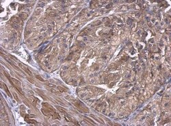 UbcH5a/UBE2D1 Antibody, Novus Biologicals 0.1mg; Unlabeled:Antibodies,