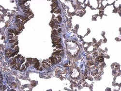 UbcH5a/UBE2D1 Antibody, Novus Biologicals 0.1mg; Unlabeled:Antibodies,
