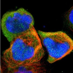 UbcH8/Ube2L6 Antibody, Novus Biologicals:Antibodies:Primary Antibodies