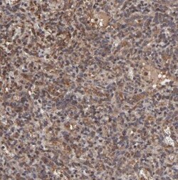 UbcH8/Ube2L6 Antibody, Novus Biologicals 25 &mu;L; Unlabeled:Antibodies,