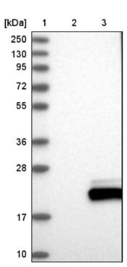 UbcH8/Ube2L6 Antibody, Novus Biologicals 25 &mu;L; Unlabeled:Antibodies,