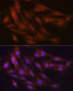 Poly-Ubiquitin Rabbit anti-Human, Mouse, Rat, Clone: 5Y8J0, Novus Biologicals:Antibodies:Primary