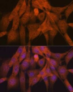 Poly-Ubiquitin Rabbit anti-Human, Mouse, Rat, Clone: 5Y8J0, Novus Biologicals:Antibodies:Primary