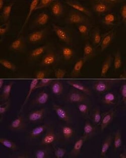 Poly-Ubiquitin Rabbit anti-Human, Mouse, Rat, Clone: 5Y8J0, Novus Biologicals:Antibodies:Primary