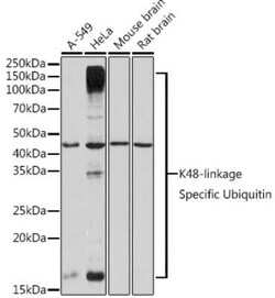 Poly-Ubiquitin Rabbit anti-Human, Mouse, Rat, Clone: 5Y8J0, Novus Biologicals:Antibodies:Primary