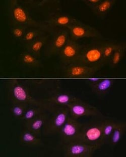 Ubiquitin-activating Enzyme/UBE1 Rabbit anti-Human, Mouse, Rat, Clone: