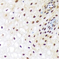 Ubiquitin-activating Enzyme/UBE1 Rabbit anti-Human, Mouse, Rat, Clone: