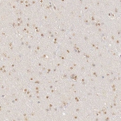 Ubiquitin-activating Enzyme/UBE1 Antibody, Novus Biologicals 0.1mL; Unlabeled:Antibodies,