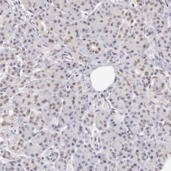 Ubiquitin-activating Enzyme/UBE1 Antibody, Novus Biologicals 0.1mL; Unlabeled:Antibodies,