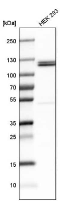 Ubiquitin-activating Enzyme/UBE1 Antibody, Novus Biologicals 0.1mL; Unlabeled:Antibodies,