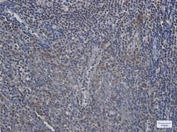 Ufc1 Rabbit anti-Human, Mouse, Rat, Clone: S08-5E1, Novus Biologicals 100 &mu;g | Buy Online | Novus Biologicals | Fisher Scientific