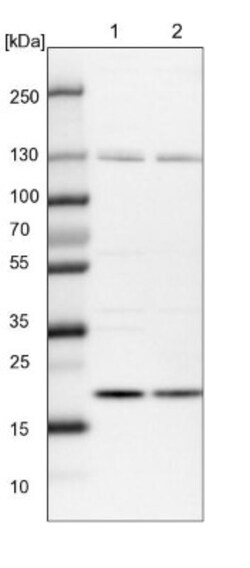 Ufc1 Antibody, Novus Biologicals 0.1 mL | Buy Online | Novus Biologicals | Fisher Scientific