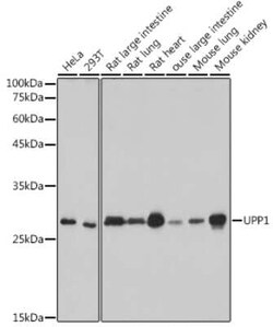 Uridine Phosphorylase 1/UPP1 Rabbit anti-Human, Mouse, Rat, Clone: 3E2I2,