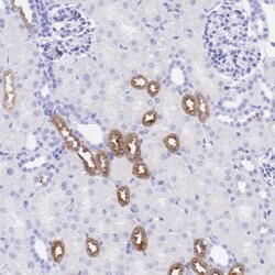 Uromodulin Antibody, Novus Biologicals 0.1mL; Unlabeled:Antibodies, Polyclonal