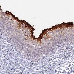 Uroplakin II Antibody, Novus Biologicals:Antibodies:Primary Antibodies
