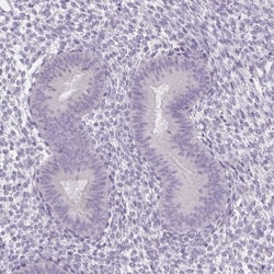 Uroplakin II Antibody, Novus Biologicals 25 &mu;L, Unlabeled:Antibodies,