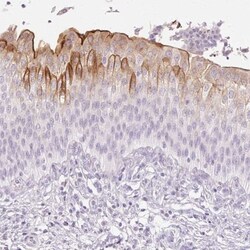 Uroplakin II Antibody, Novus Biologicals 25 &mu;L, Unlabeled:Antibodies,