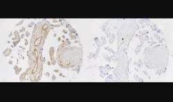 Uroplakin IIIB Antibody, Novus Biologicals:Antibodies:Primary Antibodies