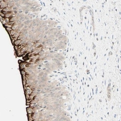 Uroplakin IIIB Antibody, Novus Biologicals:Antibodies:Primary Antibodies