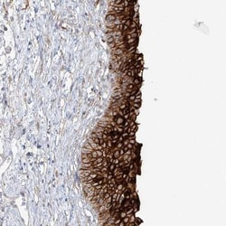 Uroplakin Ib Antibody, Novus Biologicals 0.1mL; Unlabeled:Antibodies, Polyclonal