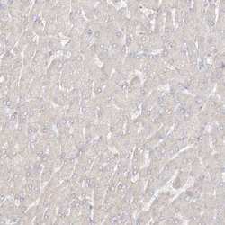 Uroplakin Ib Antibody, Novus Biologicals:Antibodies:Primary Antibodies